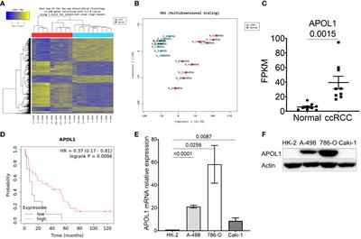 Apolipoprotein L1 is a tumor suppressor in clear cell renal cell carcinoma metastasis